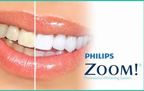 ZOOM Teeth Whitening system near Warrenville, IL