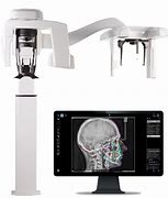 Using A 3D CT-Scan For Dental Implants